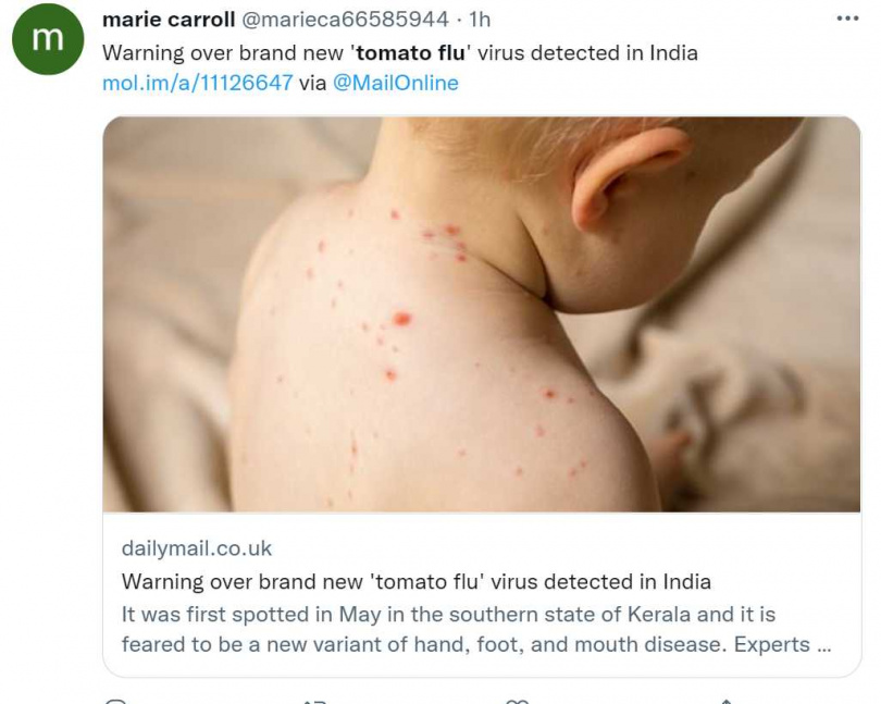 感染「番茄流感」的兒童皮膚會出現像番茄一樣的紅疹和水泡。（圖／翻攝自推特）