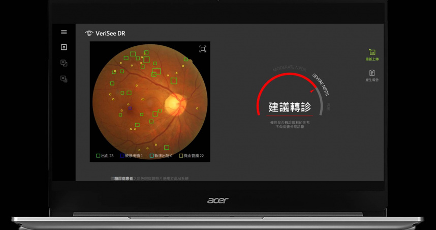 宏碁智醫旗下眼科AI軟體 VeriSee DR，協助醫師判讀眼底影像。（圖／宏碁智醫提供）