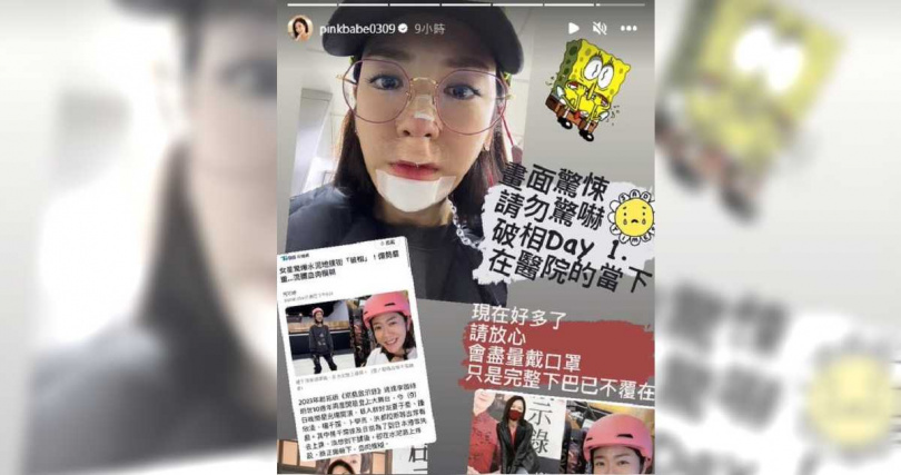 楊千霈在Instagram的限時動態中曬出臉部包紮的照片，透露「現在好多了，請放心」。（圖／翻攝自Instagram／@pinkbabe0309）
